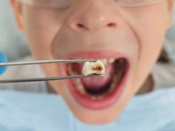 Best Emergency TMJ Treatment in Dilworth, MN